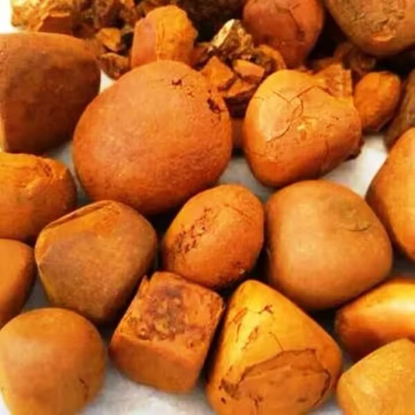 Gallstones 1